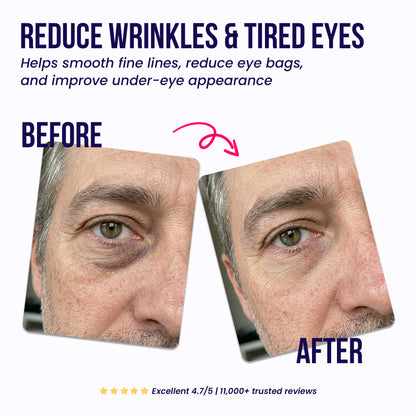Under-Eye Repair Patches