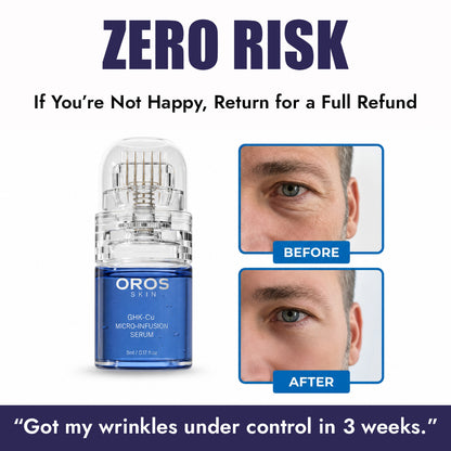OROS GHK-Cu Micro Infusion System