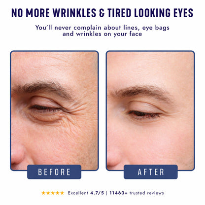 Under-Eye Repair Patches